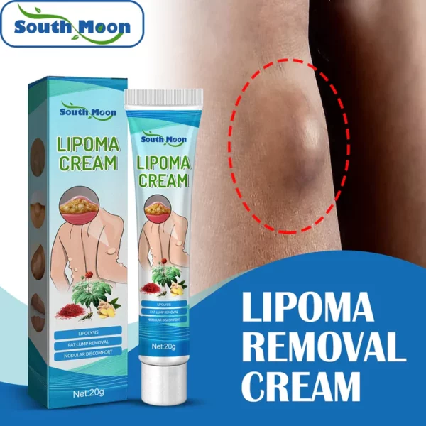 South Moon LumpFree Lipoma Removal Cream - Image 3