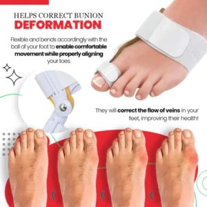 ToeAlign™ Bunion Cream & Corrector Set