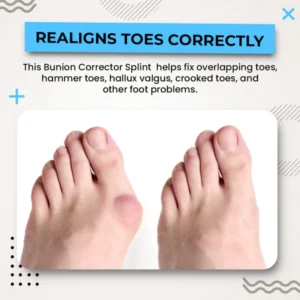 Alayna™ 3D Bunion Splint Corrector