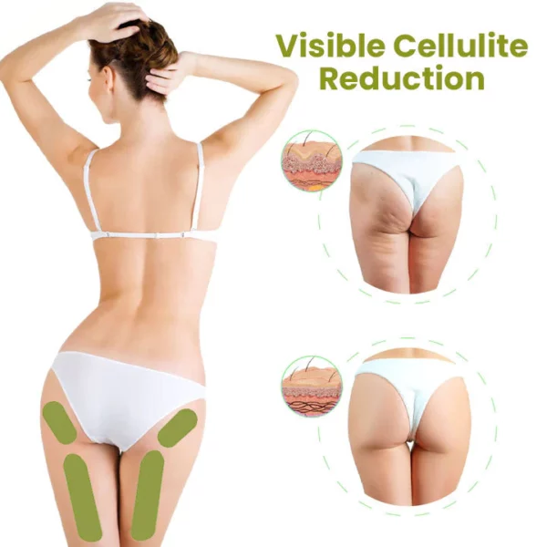 Audgx HerbalFirm Cellulite Reduction Patches