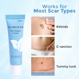 Biancat™ ScarClear Skin Repair Cream