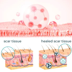 CNDB Bioskin™ Advanced Scar Removal Gel