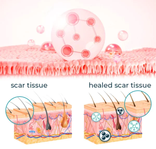 CNDB Bioskin™ Advanced Scar Removal Gel