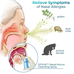 CNDB GFOUK™ Nasal Mucus Cleansing Spray