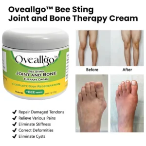 CNDB Oveallgo™ Bee Sting Joint and Bone Therapy Cream