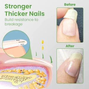 Ceoerty™ Nail Rescue Growth & Strengthening Roller