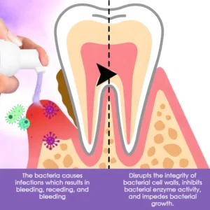 DentiCare™ Gum Treatment Foam