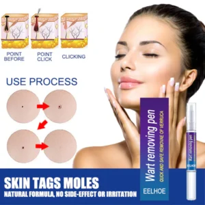 EELHOE ™ Skin Tag Remover