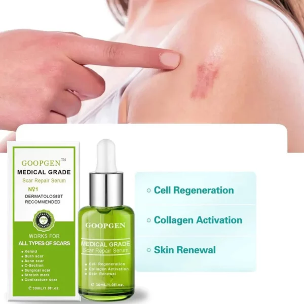 ADVANCED SCAR REPAIR SERUM FOR ALL TYPES OF SCARS