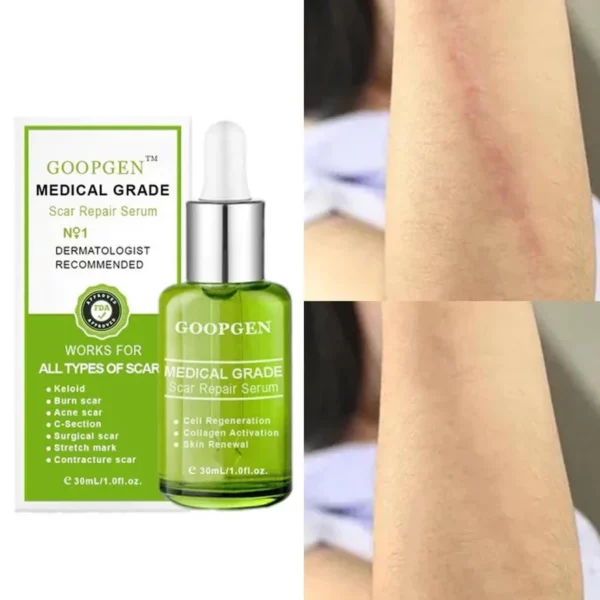 ADVANCED SCAR REPAIR SERUM FOR ALL TYPES OF SCARS