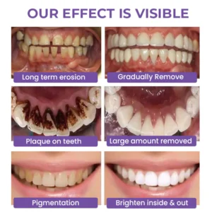 Fivfivgo™ Deluxe Herbal Teeth Whitening Mousse