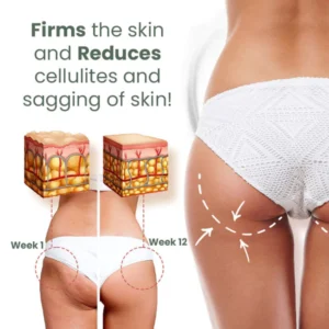 Fivfivgo™ Wormwood Cellulite AwayWith Skin Tightening Cream