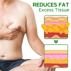 GFOUK™ TurmericMax Gynecomastia Compress Patch