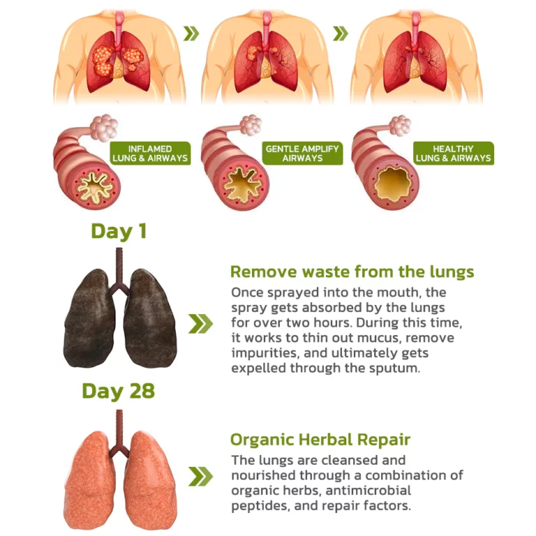 GFOUK™️ BreathDetox Herbal Lung Cleansing Spray - Image 4