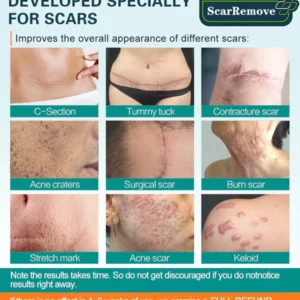 HealthX™ Advanced Scar Spray