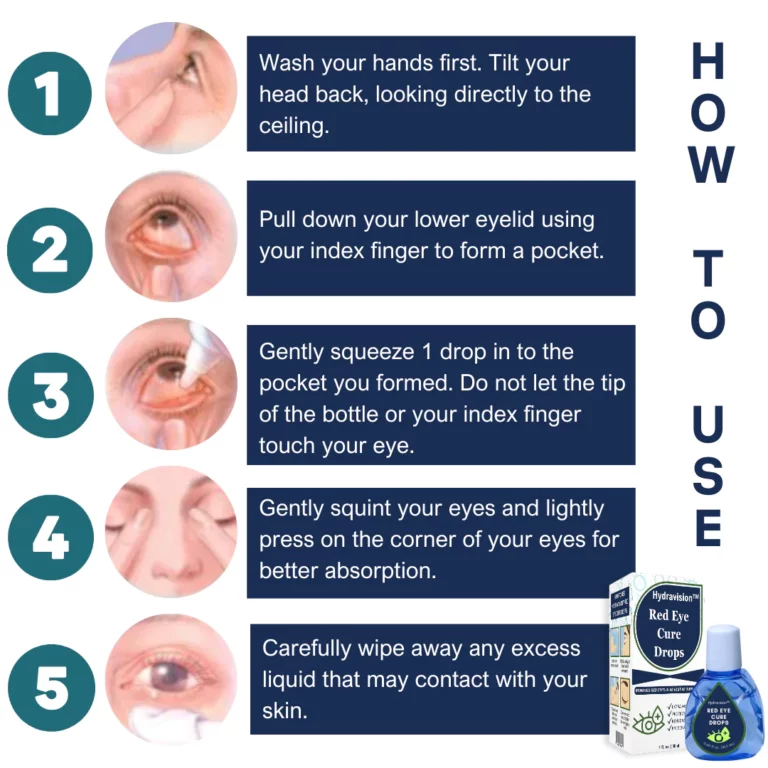 Hydravision™ Red Eye Cure Drops - Image 5