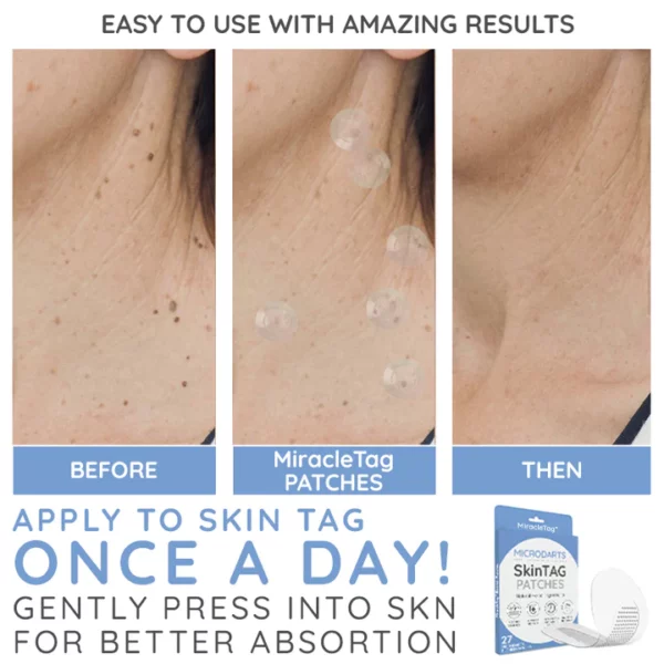 MiracleTag™ MicroDarts SkinTAG Blemish Patches