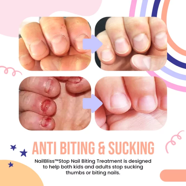 NailBliss™Stop Nail Biting Treatment