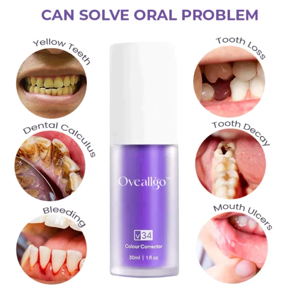 Oveallgo™ Deluxe Herbal Teeth Whitening Mousse