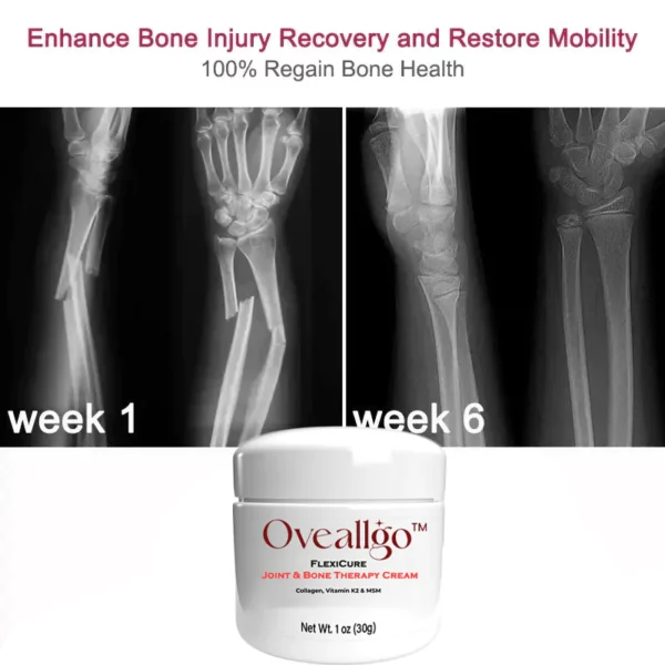 Oveallgo™ FlexiCure Joint & Bone Therapy Cream