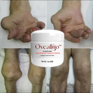 Oveallgo™ FlexiCure Joint & Bone Therapy Cream