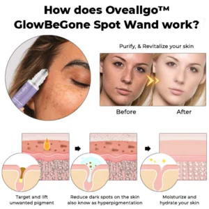 Oveallgo™ GlowBeGone Spot Wand