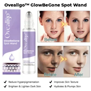 Oveallgo™ GlowBeGone Spot Wand