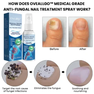 Oveallgo™ Medical Grade Anti-Fungal Nail Treatment Spray