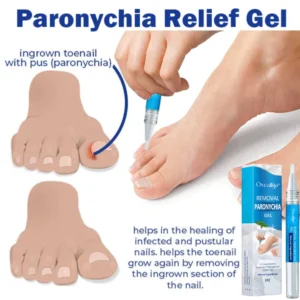 Oveallgo™ Removal Paronychia Gel