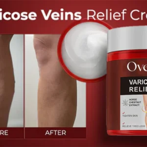 Oveallgo™ Varicose Veins Relief Cream