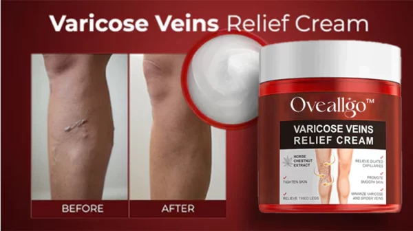 Oveallgo™ Varicose Veins Relief Cream