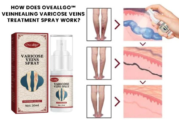 Oveallgo™ VeinHealing Varicose Veins Treatment Spray