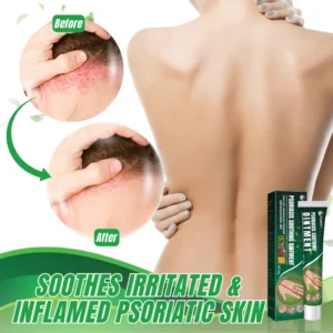 PUREX™ PSORIASIS SOOTHING OINTMENT