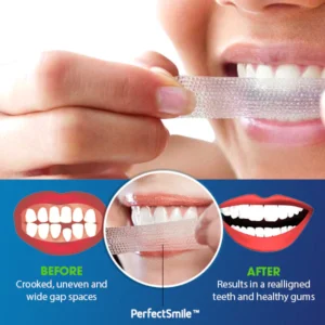 PerfectSmile™ Orthodontics Repair Stickers