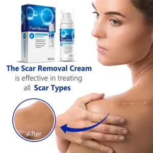 PureSkin™ Vitamin B12 Scar Repair Cream