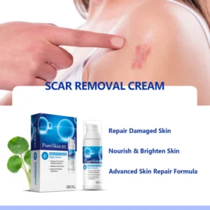 PureSkin™ Vitamin B12 Scar Repair Cream