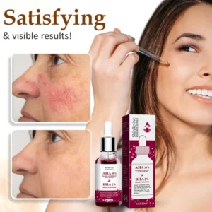 SkinRevive™ Rosacea Cure Serum