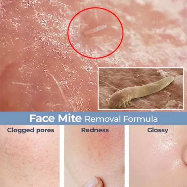 Skinetic™ Amino Acid Mite Removal Facial Cleanser