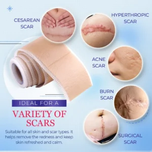 Ultracare™Medical Grade Silicone Scar Sheets