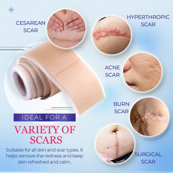 Ultracare™Medical Grade Silicone Scar Sheets