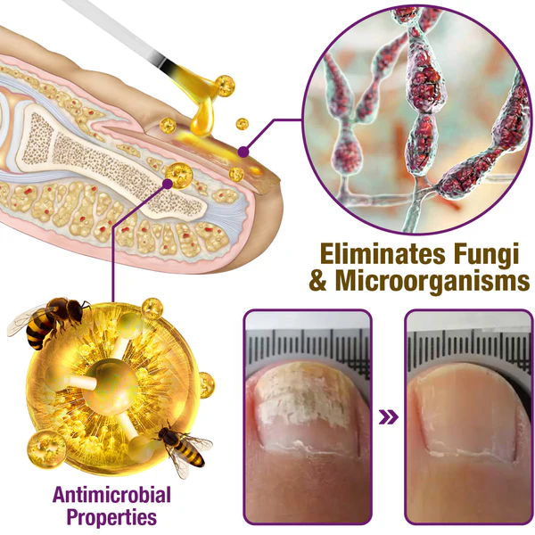 AQA™ FungiFree Bee Venom Nail Treatment Serum