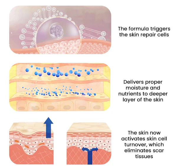 BeevHeal™ Scar Removal Spray