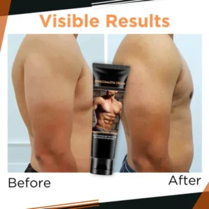 AQA™Gynecomastia Cream