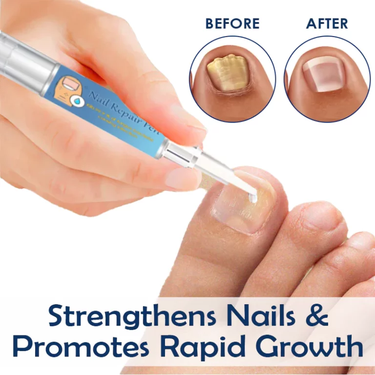 ATTDX NailRepair Fungus Treatment Pen