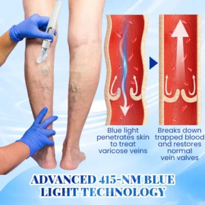 Biancat™ Blue Light Therapy Set for Varicose Veins