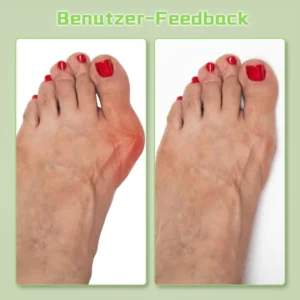 Biancat™ Hallux Valgus Entlastungspflaster