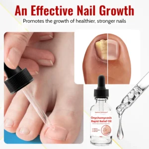 Biancat™ Japanese NailRenew Onychomycosis Rapid Relief Oil