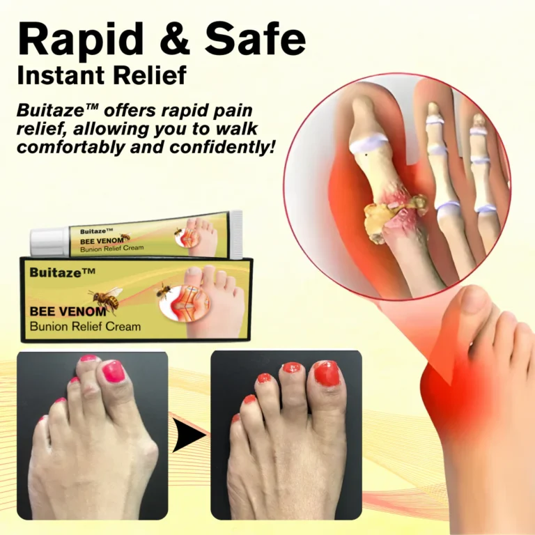 Buitaze™ Bee Venom Bunion Relief Cream