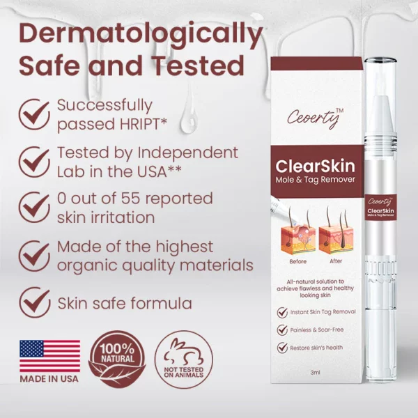 Ceoerty™ ClearSkin Mole & Tag Remover - Image 2