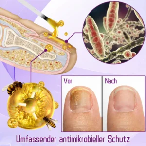 Ceoerty™ FungiShield Bienengift Zehennagelserum